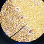 Nervoussystem010