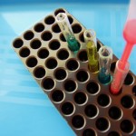 blood test1