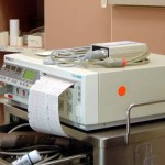 ecg