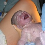 neonato2