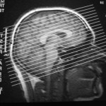 xray1