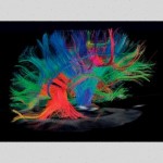 brain_brain brain_brain