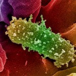 Escherichia_coli