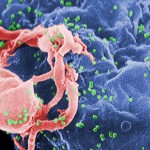 Vaccino HIV