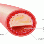 Colesterolo