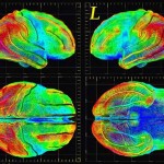 Neuroimaging Neuroimaging