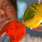 Escherichia coli per combattere la Sindrome di Rett