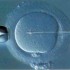 La fecondazione assistita aumenta il rischio di malformazioni congenite