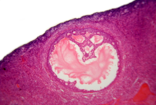 tessuto-ovaia