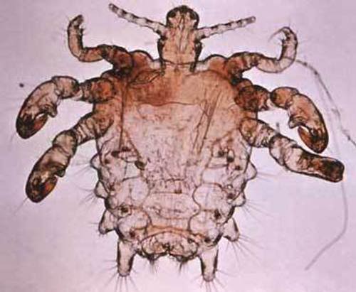 crab-louse