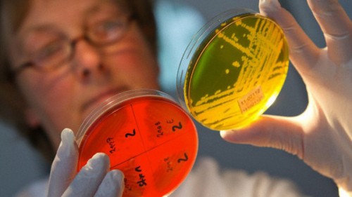 Escherichia coli per combattere la Sindrome di Rett