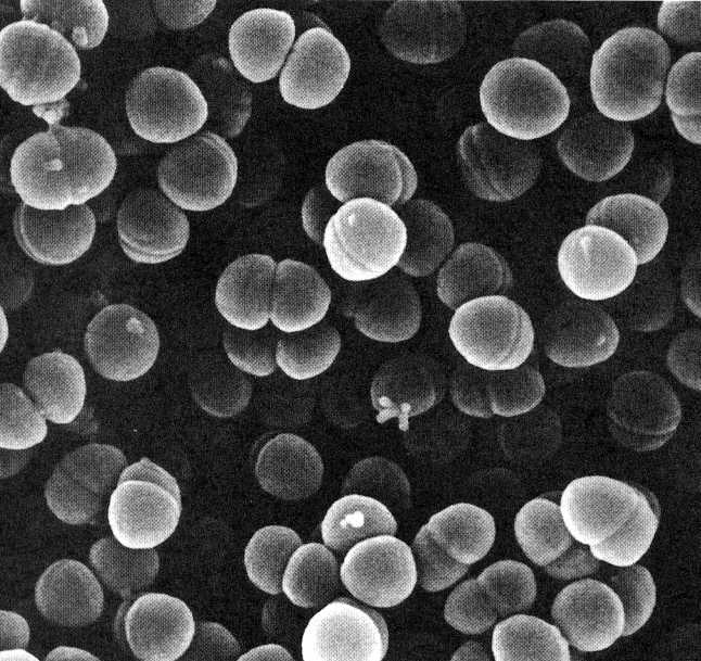 Individuato il funzionamento dei prioni