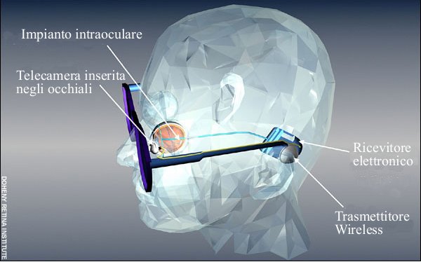 Tecnologia bionica per sconfiggere la cecità