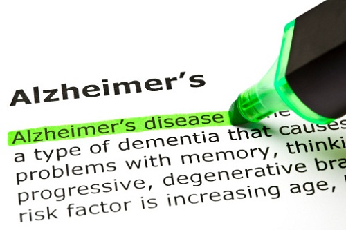 alzheimer cause prevenzione